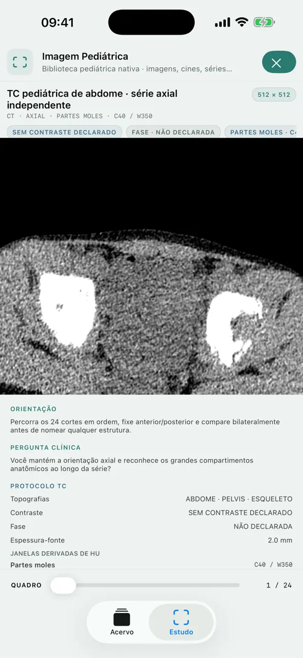 Tela do MedLink no iPhone com uma TC pediátrica de abdome, orientação de leitura e protocolo do exame
